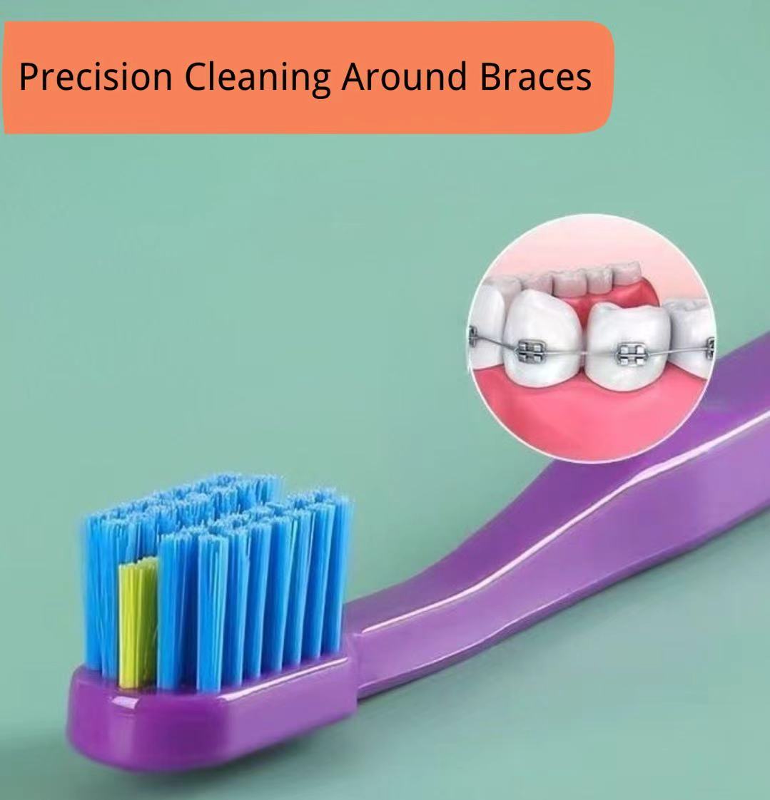 (50 units) Orthodontic Braces Toothbrushes Dental Tooth Brush Soft Bristle